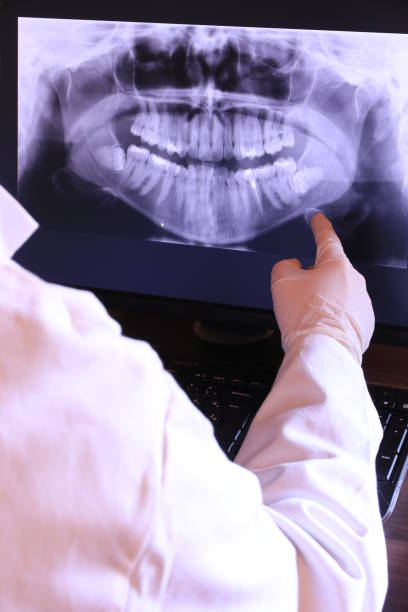 Best Emergency Dental Extractions in Hansville, WA